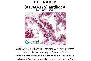 Image no. 1 for anti-RAD52 Homolog (S. Cerevisiae) (RAD52) (AA 360-375) antibody (ABIN1738702) (RAD52 Antikörper  (AA 360-375))