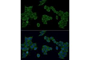 Immunofluorescence analysis of HeLa cells using IRF3 antibody (ABIN6128099, ABIN6142528, ABIN6142531 and ABIN7101371) at dilution of 1:100 (40x lens). (IRF3 Antikörper  (AA 1-260))