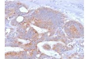 Immunohistochemistry (IHC) image for anti-CD86 (CD86) antibody (ABIN6941144)