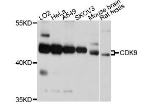 Western blot analysis of extracts of various cell lines, using CDK9 antibody (ABIN5995939) at 1/1000 dilution. (CDK9 Antikörper)