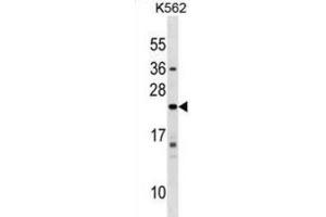 Western Blotting (WB) image for anti-Interferon, alpha 10 (IFNa10) antibody (ABIN2999555) (IFNA10 Antikörper)