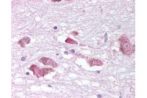 Anti-MCHR1 antibody IHC of human brain, substantia nigra. (MCHR1 Antikörper  (C-Term))