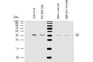 Western Blotting (WB) image for anti-Signaling threshold Regulating Transmembrane Adaptor 1 (SIT1) antibody (ABIN94465)