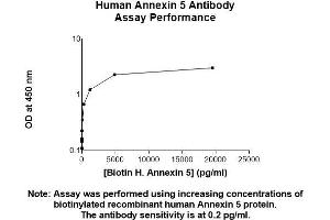 Image no. 2 for anti-Annexin A5 (ANXA5) (AA 1-320) antibody (ABIN5564834) (Annexin V Antikörper  (AA 1-320))