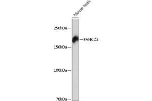 Western blot analysis of extracts of mouse testis, using F antibody (ABIN7267126) at 1:1000 dilution. (FANCD2 Antikörper)