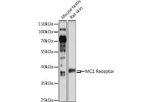 Western blot analysis of extracts of various cell lines, using MC1 Receptor antibody (ABIN6132878, ABIN6143610, ABIN6143612 and ABIN6217539) at 1:1000 dilution. (MC1 Receptor Antikörper  (AA 1-80))