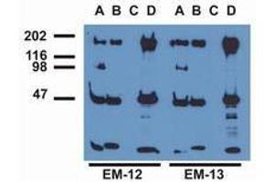 Western Blotting (WB) image for anti-Epidermal Growth Factor Receptor (EGFR) (pTyr1016) antibody (ABIN400878) (EGFR Antikörper  (pTyr1016))