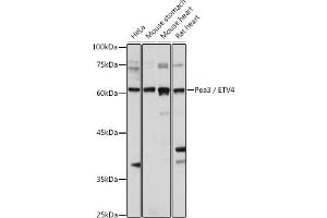 Western Blotting (WB) image for anti-Ets Variant 4 (ETV4) (AA 1-207) antibody (ABIN6140332)