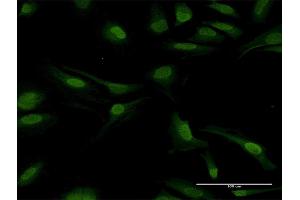 Immunofluorescence of purified MaxPab antibody to PPP2CB on HeLa cell. (PPP2CB Antikörper  (AA 1-309))