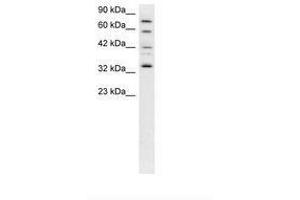 Image no. 3 for anti-Cyclin-Dependent Kinase 7 (CDK7) (C-Term) antibody (ABIN202294) (CDK7 Antikörper  (C-Term))