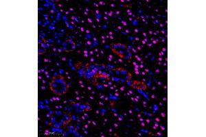 Immunofluorescence of paraffin embedded rat kidney using pax2 (ABIN7074974) at dilution of 1:600 (350x lens) (PAX2A Antikörper)