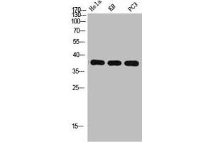 Western Blot analysis of HELA KB PC-3 using p38 Polyclonal Antibody. (MAPK14 Antikörper  (C-Term))