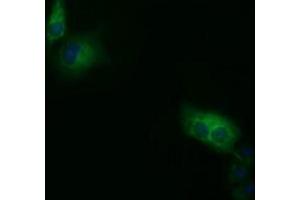 Anti-SDR9C7 mouse monoclonal antibody (ABIN2453629) immunofluorescent staining of COS7 cells transiently transfected by pCMV6-ENTRY SDR9C7 (RC210941). (SDR9C7 Antikörper)