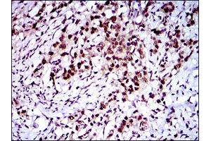 Immunohistochemistry (IHC) image for anti-CASP8 and FADD-Like Apoptosis Regulator (CFLAR) (AA 100-251) antibody (ABIN1724850)