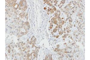 IHC-P Image Immunohistochemical analysis of paraffin-embedded A549 xenograft, using AHA-1, antibody at 1:100 dilution. (AHSA1 Antikörper  (Center))