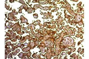 Formalin-fixed, paraffin-embedded human Placenta stained with PLAP Monoclonal Antibody (SPM593). (PLAP Antikörper)