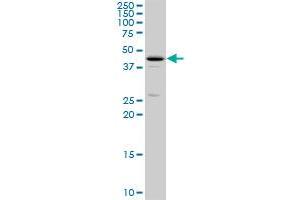 THRA polyclonal antibody (A01), Lot # ABNOVA060629QCS1. (THRA Antikörper  (AA 87-178))