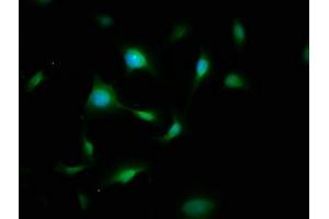 Immunofluorescence staining of U251 cells with ABIN7174025 at 1:200, counter-stained with DAPI. (FYN Antikörper  (AA 154-270))