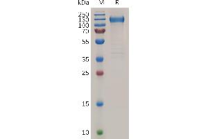 Human  Protein, His Tag on SDS-PAGE under reducing condition. (FLT1 Protein (AA 27-756) (His tag))