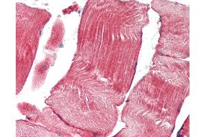 Anti-TNK1 antibody IHC staining of human skeletal muscle. (TNK1 Antikörper  (AA 517-566))
