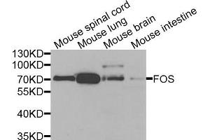Western blot analysis of extracts of various cell lines, using FOS antibody (ABIN5970066) at 1/1000 dilution. (c-FOS Antikörper  (Center))
