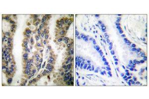 Immunohistochemistry (IHC) image for anti-Heat Shock 60kDa Protein 1 (Chaperonin) (HSPD1) (C-Term) antibody (ABIN1848614) (HSPD1 Antikörper  (C-Term))