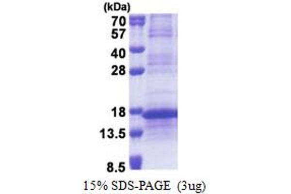 RPL35A Protein (AA 1-110) (His tag)