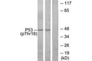 Western blot analysis of extracts from Ovary cancer and K562 cells, using p53 (Phospho-Thr18) Antibody. (p53 Antikörper  (pThr18))