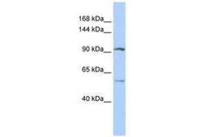 Image no. 1 for anti-Leucine Rich Repeat Containing 66 (LRRC66) (AA 756-805) antibody (ABIN6740902) (LRRC66 Antikörper  (AA 756-805))