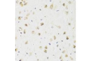 Immunohistochemistry of paraffin-embedded rat brain using PAWR Antibody. (PAWR Antikörper)