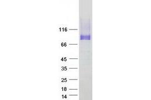 Validation with Western Blot (PODXL Protein (Transcript Variant 2) (Myc-DYKDDDDK Tag))