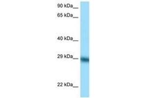 Image no. 1 for anti-Tissue Factor Pathway Inhibitor (Lipoprotein-Associated Coagulation Inhibitor) (TFPI) (C-Term) antibody (ABIN6748178) (TFPI Antikörper  (C-Term))