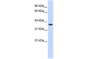 WB Suggested Anti-ZNF444 Antibody Titration:  0. (ZNF444 Antikörper  (Middle Region))