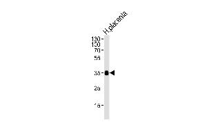 Western Blotting (WB) image for anti-Folate Receptor 2 (Fetal) (FOLR2) (AA 18-46) antibody (ABIN651222)