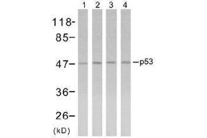 Image no. 1 for anti-Tumor Protein P53 (TP53) (Ser315) antibody (ABIN197255) (p53 Antikörper  (Ser315))