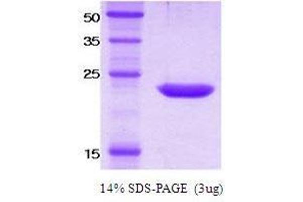 KIR2DS4 Protein