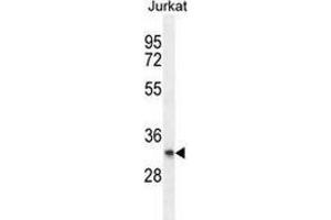 Western blot analysis in Jurkat cell line lysates (35ug/lane) using PRRG3 Antibody . (PRRG3 Antikörper  (Middle Region))
