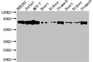 Western Blot Positive WB detected in: HEK293 whole cell lysate, Jurkat whole cell lysate, MCF-7 whole cell lysate, Rat heart tissue, Rat kideny tissue, Rat stomach tissue, Mouse heart tissue, Mouse kidney tissue, Mouse stomach tissue All lanes: PRKCH antibody at 3. (PKC eta Antikörper  (AA 1-678))