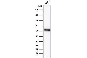 Western Blotting (WB) image for anti-Tumor Protein P53 (TP53) antibody (ABIN6940792)