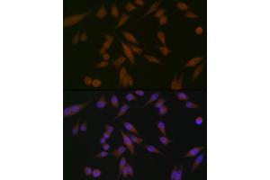 Immunofluorescence analysis of HeLa cells using P Rabbit mAb (ABIN1682842, ABIN3019312, ABIN3019313 and ABIN7101749) at dilution of 1:100 (40x lens). (PAWR Antikörper)