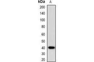 Western blot analysis of CCR5 expression in HEK293T (A) whole cell lysates. (CCR5 Antikörper)