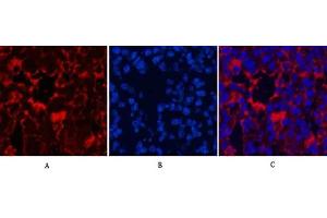 Immunofluorescence analysis of mouse lung tissue. (LC3B Antikörper)