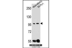 Western blot analysis in MDA-MB453,ZR-75-1 cell line lysates (35ug/lane). (Protocadherin 1 Antikörper  (N-Term))