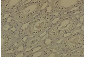 IHC analysis of DNMT1 in medullar kidney tissue sections using DNMT / DNMT1 antibody. (DNMT1 Antikörper  (AA 637-650) (Atto 390))