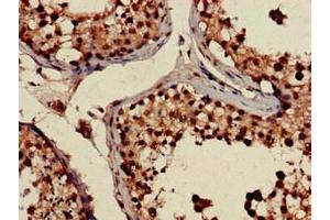Immunohistochemistry of paraffin-embedded human testis tissue using ABIN7168160 at dilution of 1:100 (PRPS2 Antikörper  (AA 11-106))