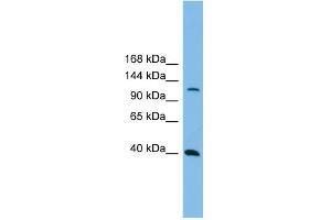 Host:  Rabbit  Target Name:  MAP3K14  Sample Tissue:  Human THP-1 Whole Cell  Antibody Dilution:  1ug/ml (MAP3K14 Antikörper  (N-Term))
