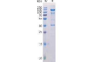 Melanoma gp100 Protein (AA 25-595) (Fc Tag)