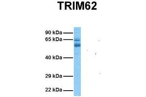 Host:  Rabbit  Target Name:  TRIM62  Sample Tissue:  Human Ovary Tumor  Antibody Dilution:  1. (TRIM62 Antikörper  (N-Term))