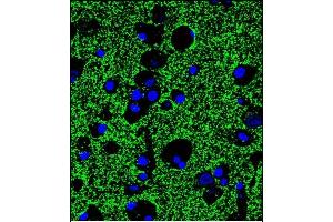 Immunofluorescence (IF) image for anti-Synaptophysin (SYP) (AA 225-253), (C-Term) antibody (ABIN1881862)