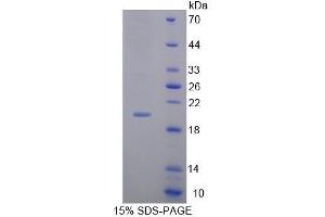 SDS-PAGE (SDS) image for Matrix Metallopeptidase 13 (Collagenase 3) (MMP13) ELISA Kit (ABIN6720554)